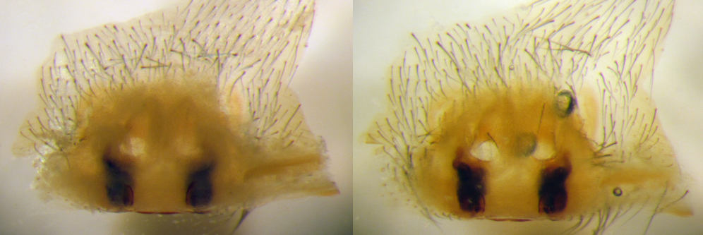 slide-prepared vulva of Pireneitega spassky (Amaurobiidae): left - in ethanol, right: in Hoyer's solution